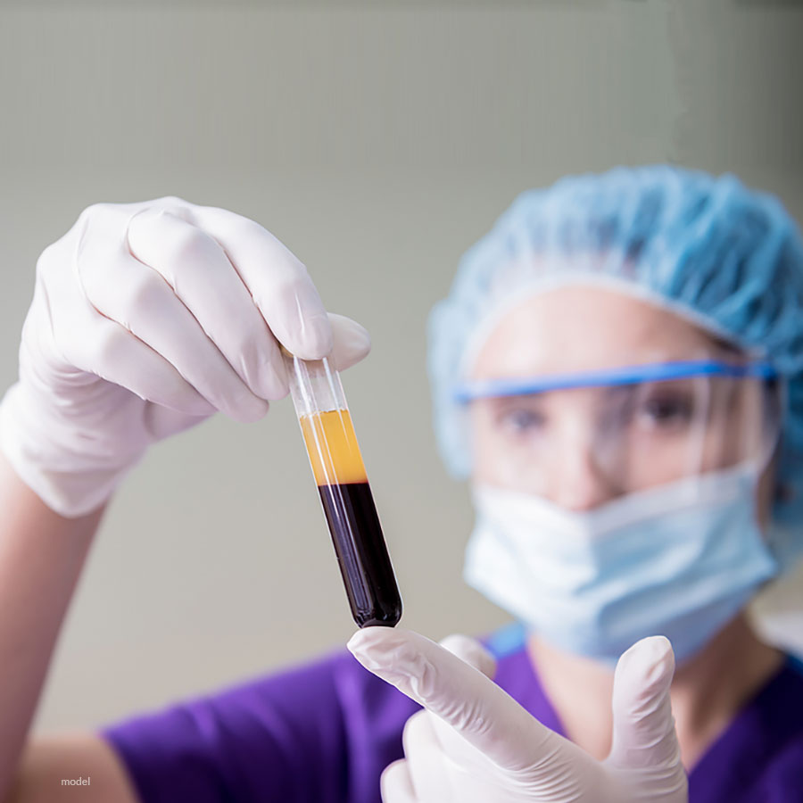 Nurse holding vial of blood with PRF separated. PRF available at Chicago Iteld Aesthetcs Institute.