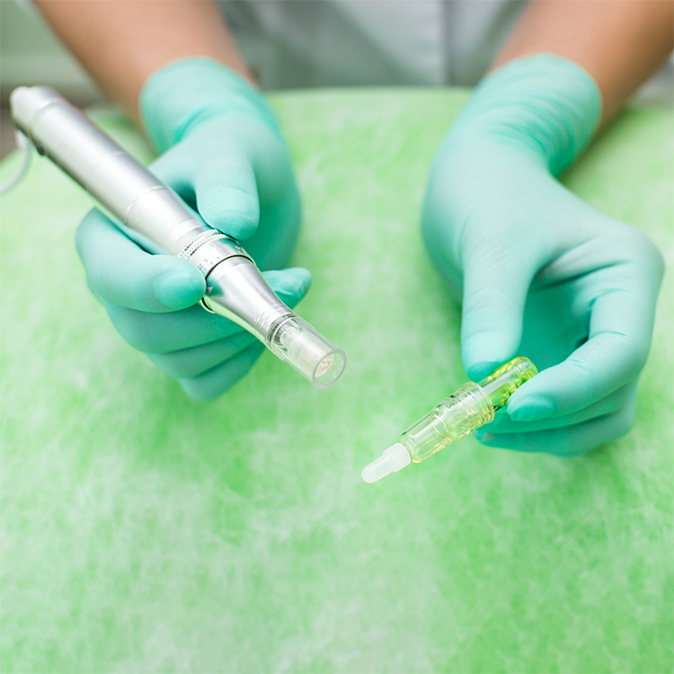 Microneedling with Exosomes